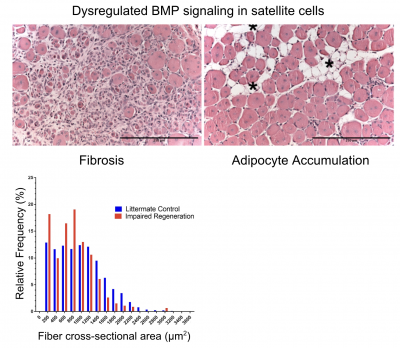 fat/fibrosis